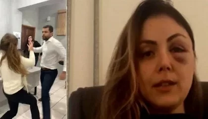 Procurador acusado de espancar chefe após diagnóstico de esquizofrenia é absolvido pela Justiça de São Paulo